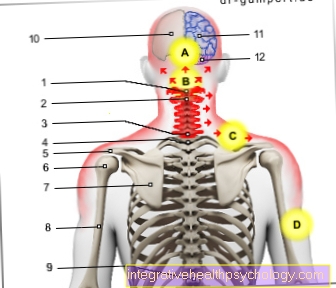 Figure cervical spine syndrome