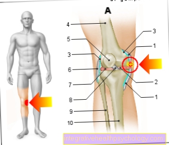Illustration of the knee ligament tear
