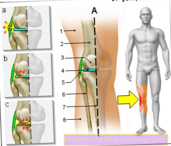 Figure knee pain on the outside