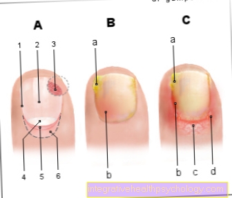 Figure nail bed inflammation