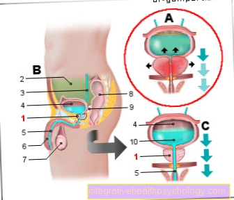 Illustration prostate enlargement