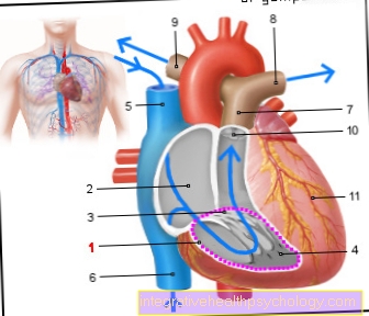 Right ventricle shown