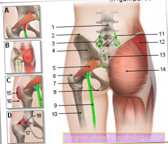 Figure pain buttock (buttock)