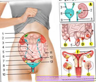 Figure abdominal pain - woman