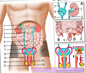 Figure abdominal pain - man