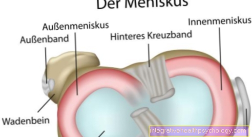 External meniscus