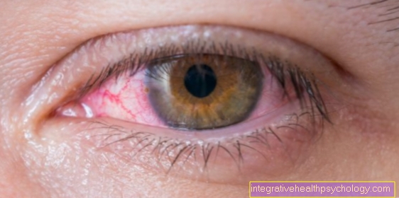 Eye muscle inflammation