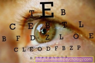Causes of Optic Atrophy