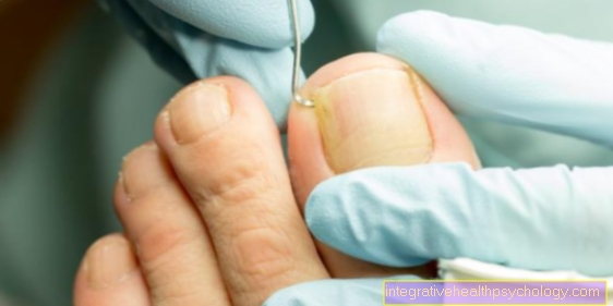 Treatment of inflammation of the nail bed