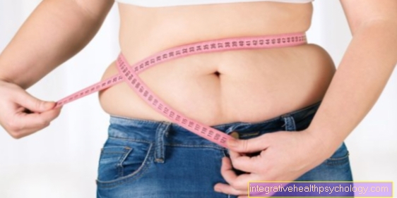 Gastric balloon for weight loss