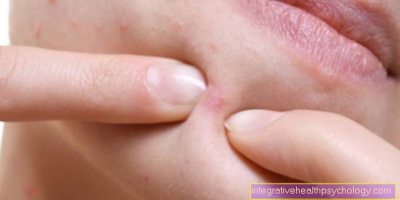 Abscess on the chin