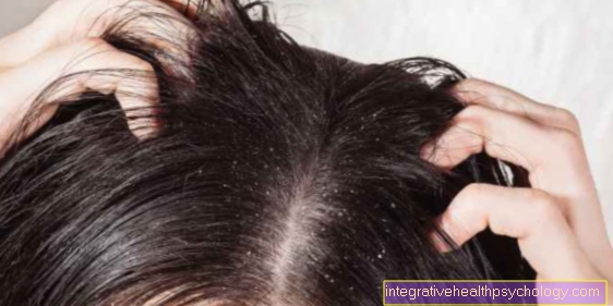 Eczema of the scalp