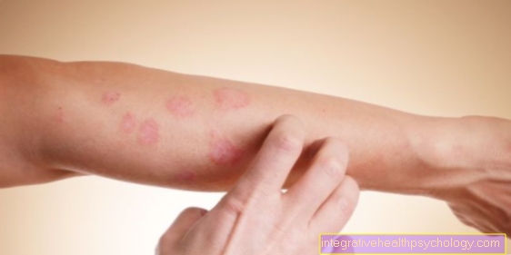 Streptococcal rash