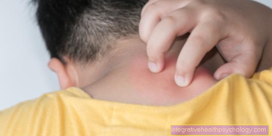 Red spots on the neck