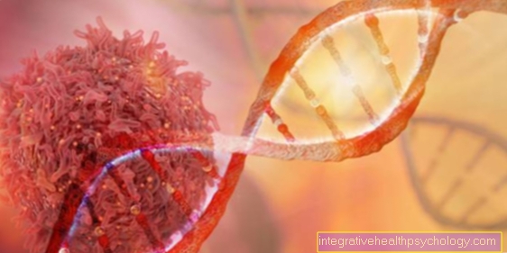 Genetic testing - when does it make sense?