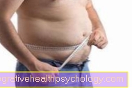 Therapy of obesity in children and adolescents