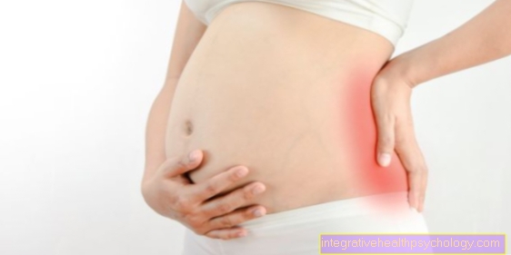 Herniated disc during pregnancy