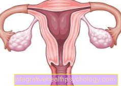 Inflammation of the uterus