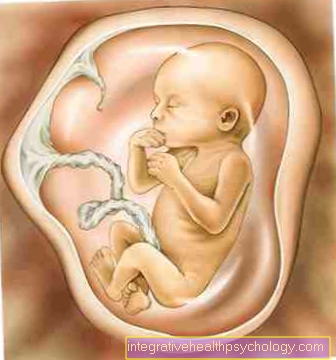 Amniotic sac