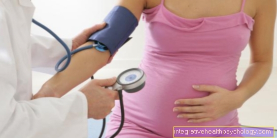 Palpitations during pregnancy