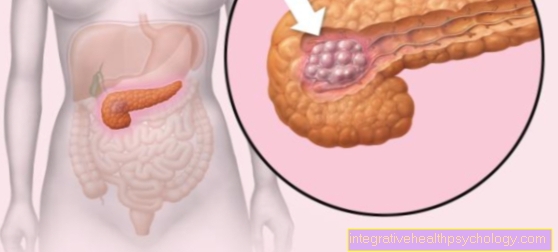 Signs of pancreatic cancer