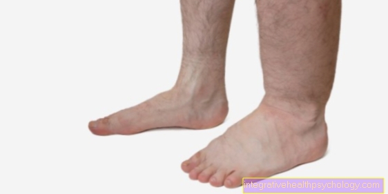 Ankle swollen on one side