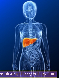 Inflammation of the gallbladder