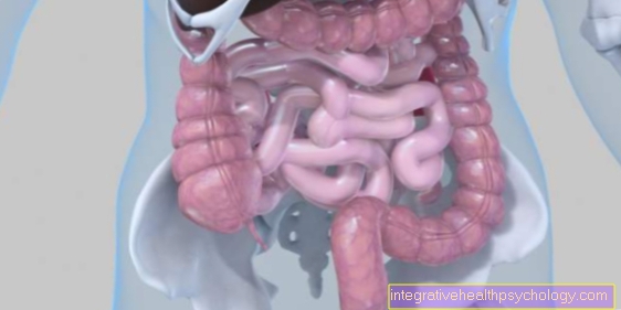 Can you cure ulcerative colitis?