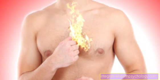 What to do about heartburn