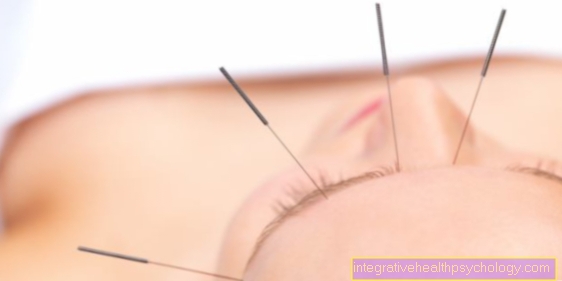 Acupuncture and childbirth preparation