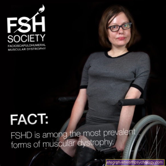 Facioscapulohumeral dystrophy (FSHD)