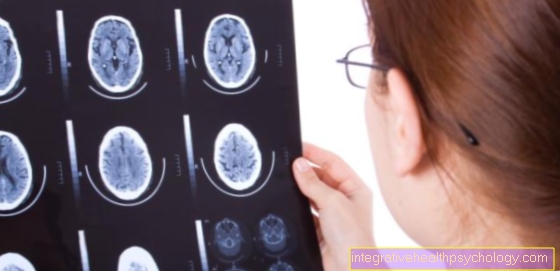 What are the consequences of a cerebral hemorrhage?