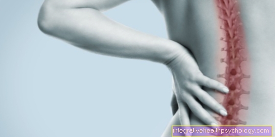 Signs of a herniated disc