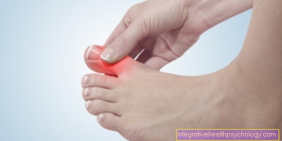 Inflammation of the toe