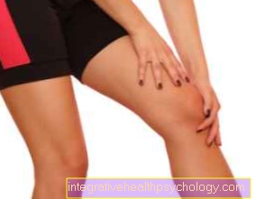 Joint swelling in the knee