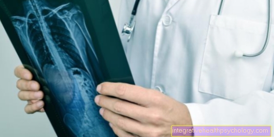 Cartilage damage in the shoulder joint