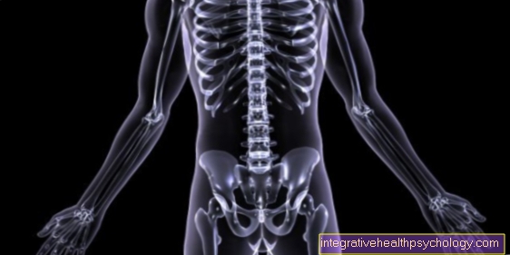 Osteoporosis in underweight