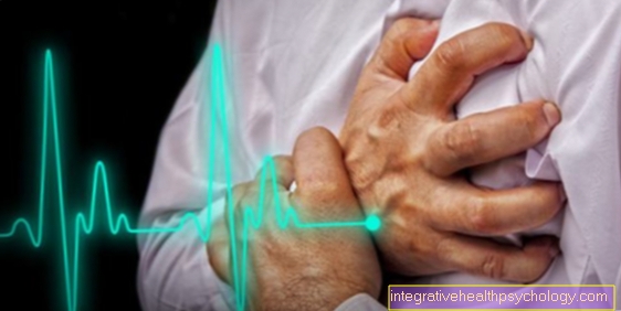 Pain in the left arm as a sign of a heart attack