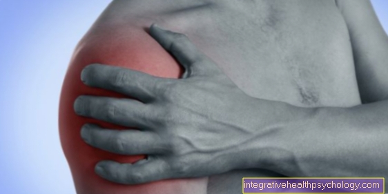 Pain in shoulder and arm