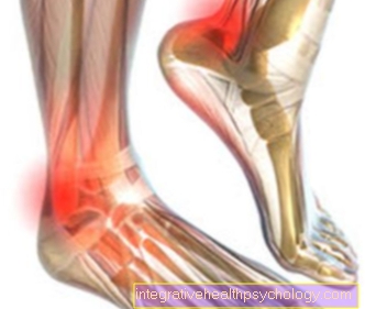 Tendonitis on the ankle