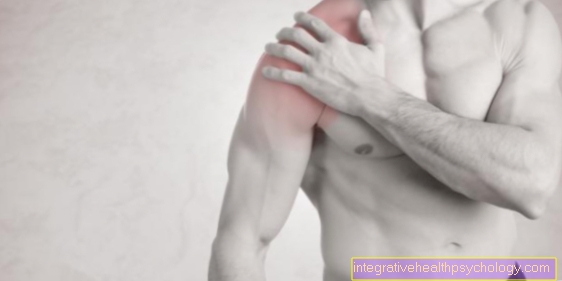 This is how a frozen shoulder is treated