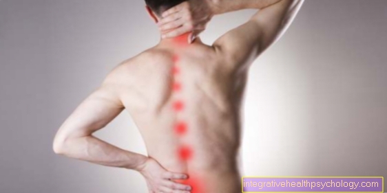Therapy of a lumbar spine syndrome