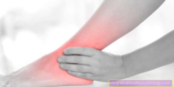 Causes of Achilles tendonitis