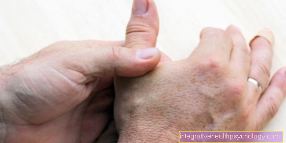 What is saddle arthritis of the thumb?