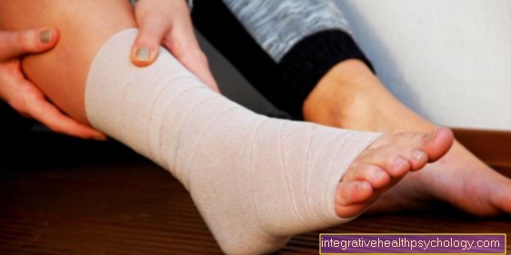 Duration of a sprain