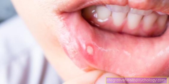 Aphthae - what helps with painful blisters in the mouth?
