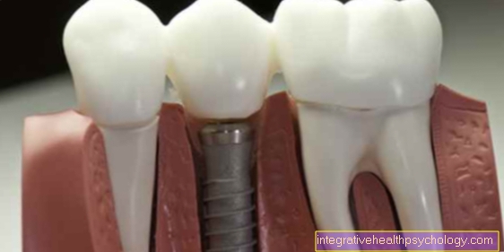 Inflammation on the dental implant