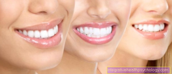 Forms of whitening