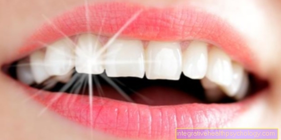 Professional teeth cleaning: how often is it necessary?