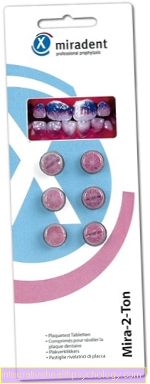 Denture cleaning with tablets